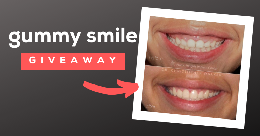 gummy smile - aesthetic crown lengthening